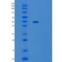 人信号调节蛋白α(SIRPa)重组蛋白