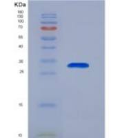 人STAM结合蛋白(STAMBP)重组蛋白