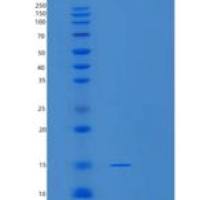 人小核糖核蛋白多肽D2(SNRPD2)重组蛋白