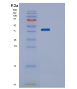 人丝氨酸/苏氨酸蛋白激酶17B（STK17B）重组蛋白