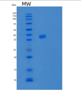 人SPG21重组蛋白
