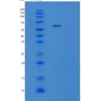 人应激诱导磷蛋白1重组蛋白