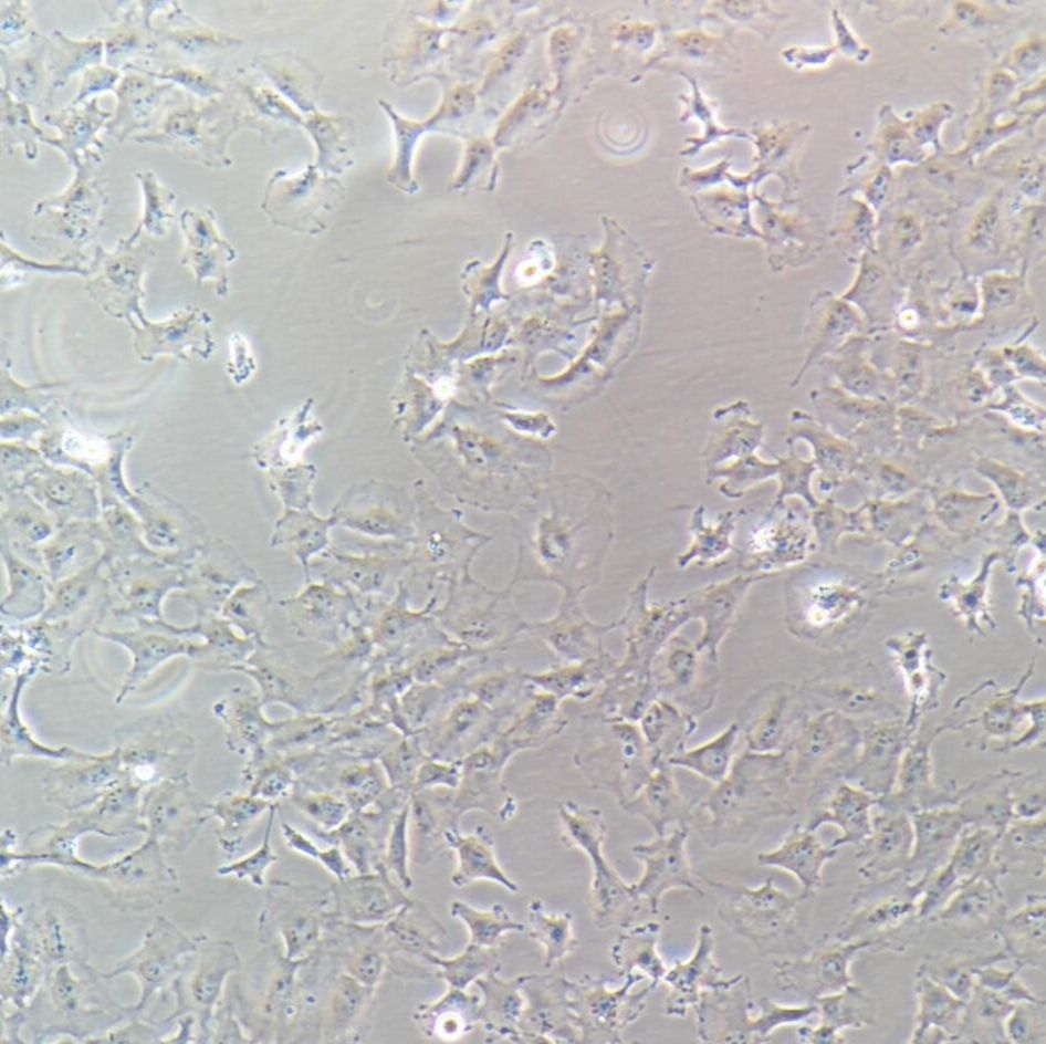 Hs578T 人乳腺癌细胞/STR鉴定/镜像绮点（Cellverse）