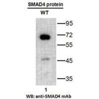 SMAD4