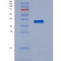 人突触融合蛋白11(STX11)重组蛋白