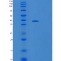 人信号调节蛋白γ(SIRPg)重组蛋白