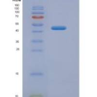 人Snurportin 1蛋白(SNUPN1)重组蛋白