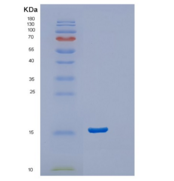 人胞浆磷蛋白2(STMN2)重组蛋白