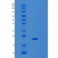 人Sentan (SNTN)重组蛋白