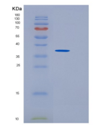 人磺基转移酶1B1(SULT1B1)重组蛋白