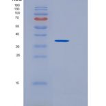 人磺基转移酶1B1(SULT1B1)重组蛋白