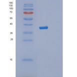 人丝氨酸/苏氨酸激酶3(STK3)重组蛋白