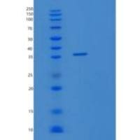 人STRADA重组蛋白
