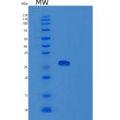 人胞浆磷蛋白4(STMN4)重组蛋白