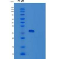 人胞浆磷蛋白4(STMN4)重组蛋白