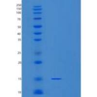 人精子线粒体关联半胱氨酸丰富的蛋白(SMCP)重组蛋白