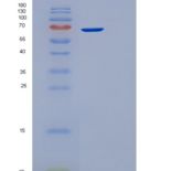 人应激诱导磷蛋白1(STIP1)重组蛋白