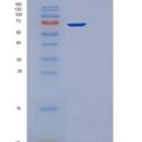 人应激诱导磷蛋白1(STIP1)重组蛋白
