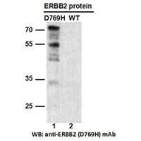 ERBB2(D769H)