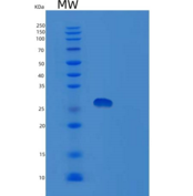 人胞浆磷蛋白4(STMN4)重组蛋白