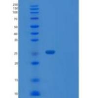 人SIKE1重组蛋白