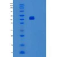 人ST6GAL1重组蛋白