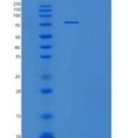 人唾液酸结合Ig样凝集素5(SIGLEC5)重组蛋白
