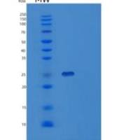 人SSU72重组蛋白