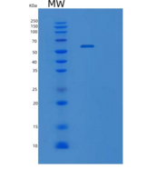人应激诱导磷蛋白1重组蛋白