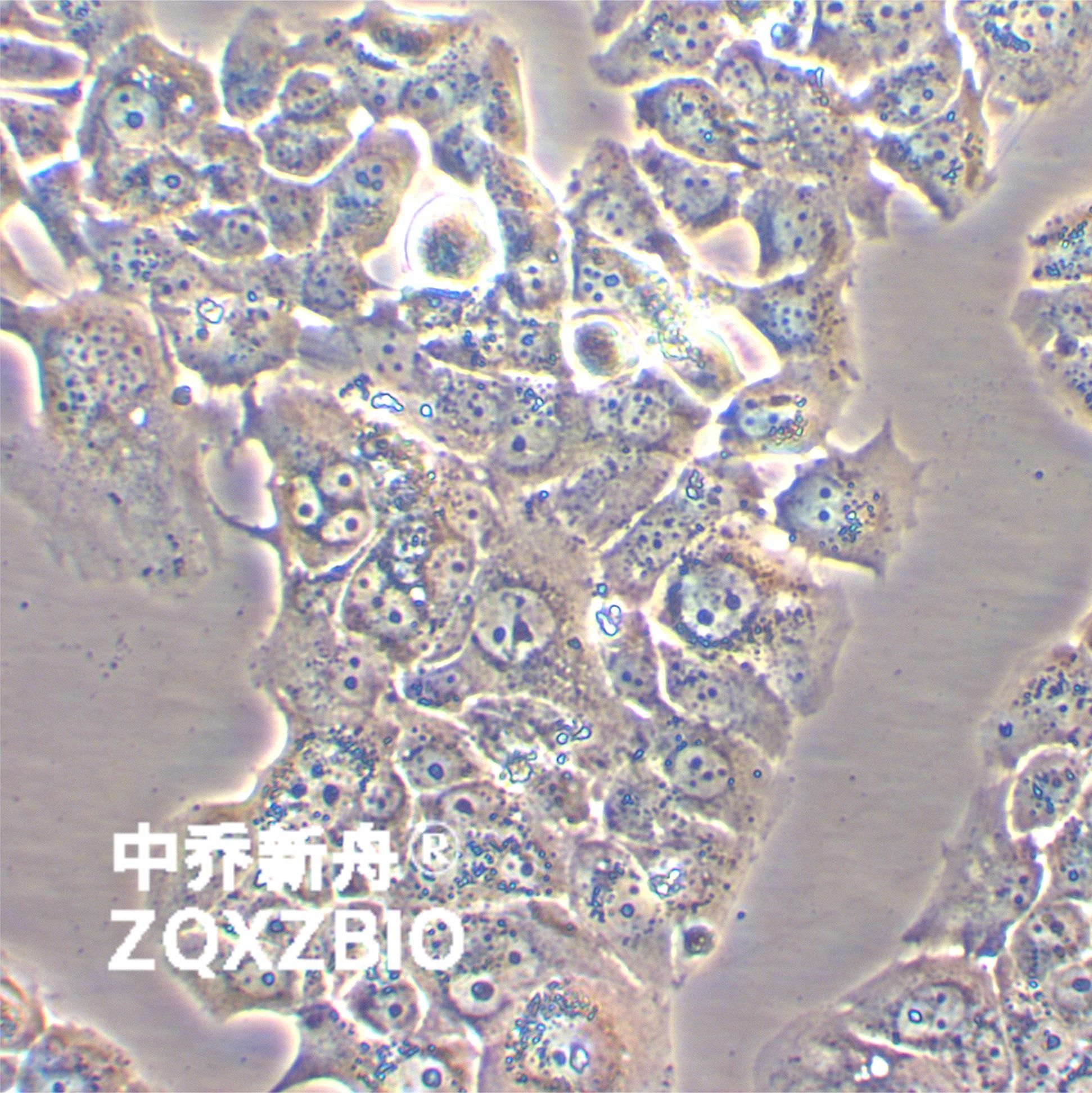 HCC1428人乳腺腺癌细胞