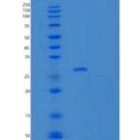 人精子关联抗原7(SPAG7)重组蛋白
