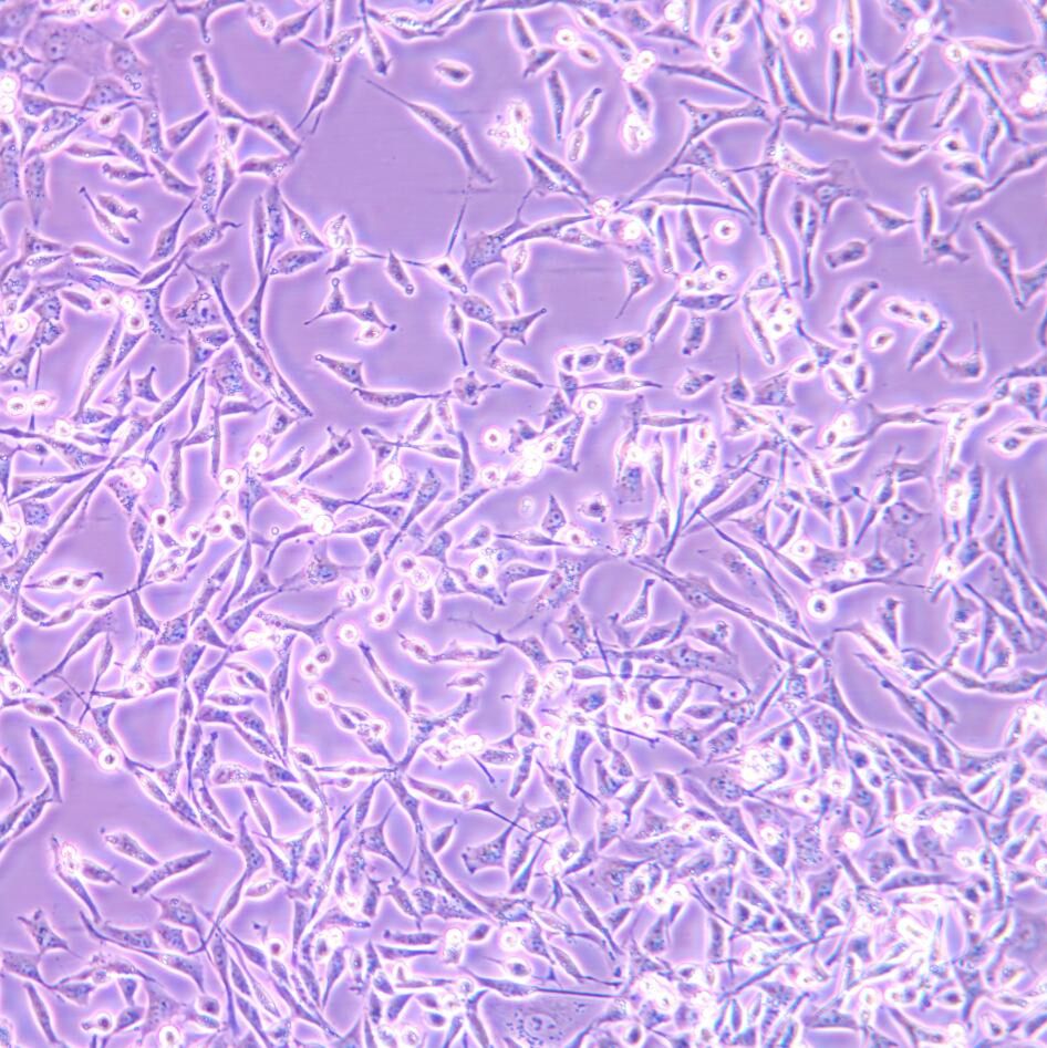 A-204人横纹肌肉瘤细胞/STR鉴定/镜像绮点（Cellverse）