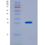 人线粒体超氧化物歧化酶(SOD2)重组蛋白