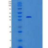 人SORBS3重组蛋白
