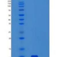 人小核糖核蛋白多肽F(SNRPF)重组蛋白