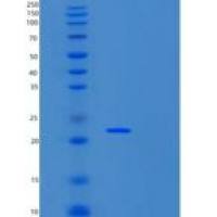 大肠杆菌25kDa突触关联蛋白(SNAP25)重组蛋白