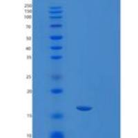 人SRP14重组蛋白