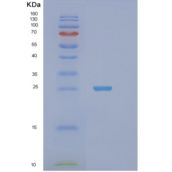 人STXBP6重组蛋白