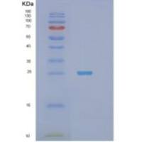 人STXBP6重组蛋白