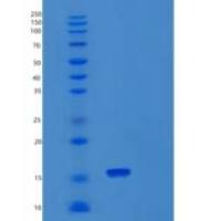 人小核糖核蛋白多肽D3(SNRPD3)重组蛋白
