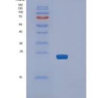 人SLAM family member 7重组蛋白