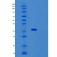 人类固醇合成急性调节蛋白(STAR)重组蛋白