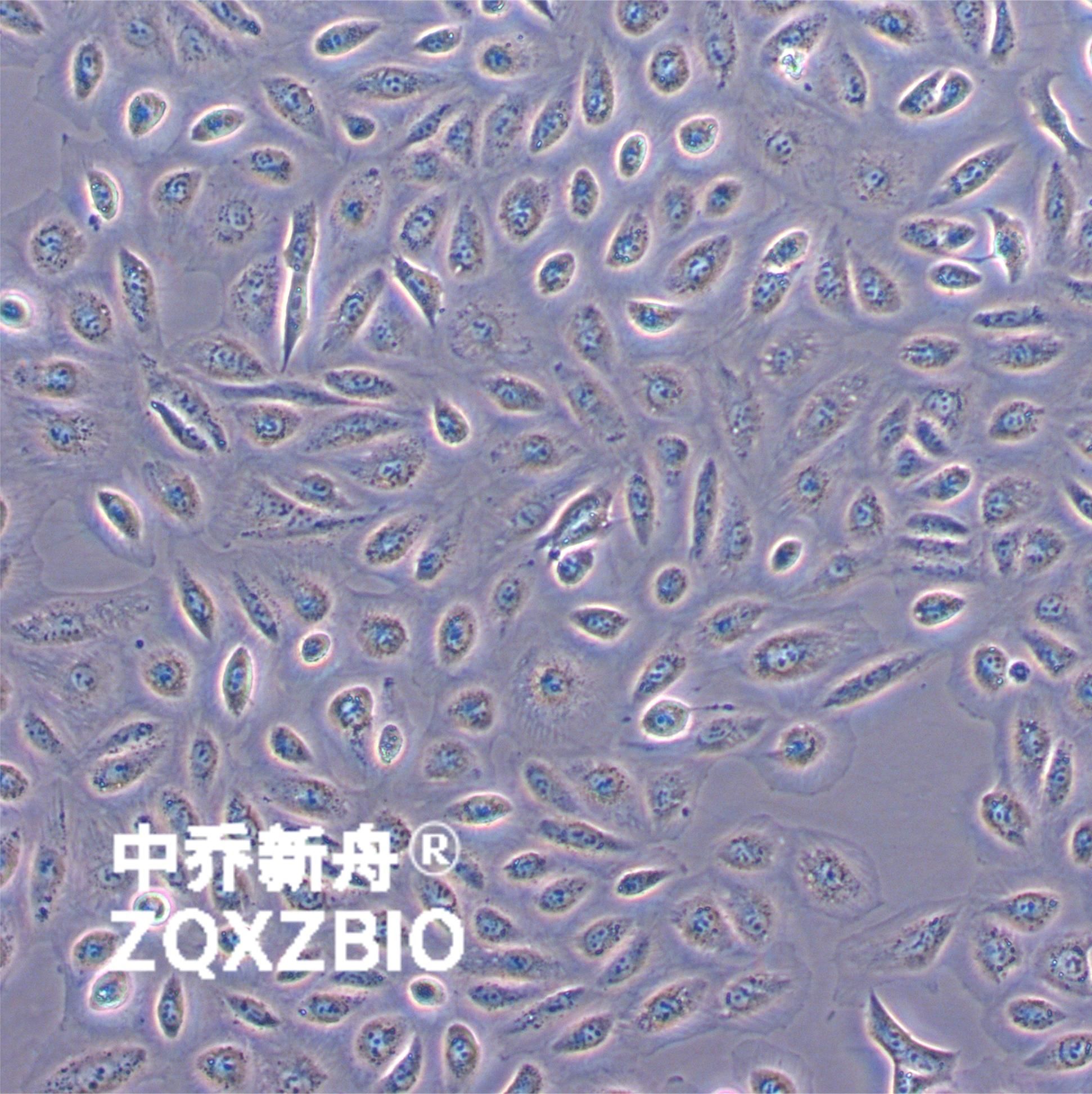 TPC-1 甲状腺乳头状癌细胞株