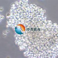 NCI-H69人小细胞肺癌细胞