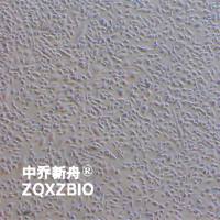 HS-5人永生化骨髓细胞