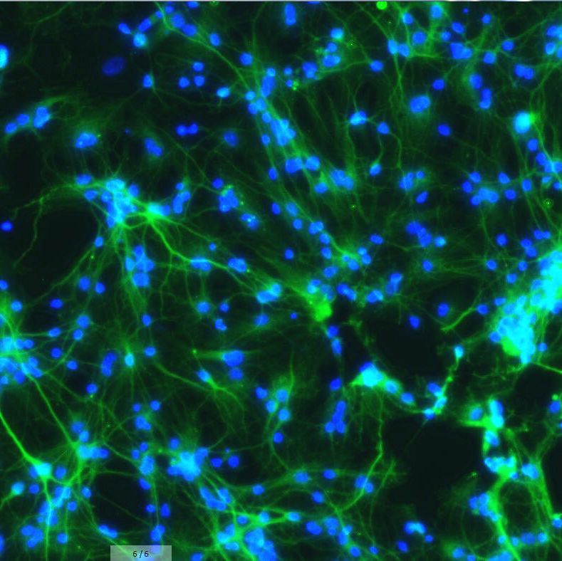 大鼠三叉神经元细胞  免疫荧光鉴定 镜像绮点（Cellverse）