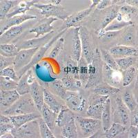 HOS人骨肉瘤细胞