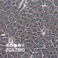 MKN74人胃癌细胞