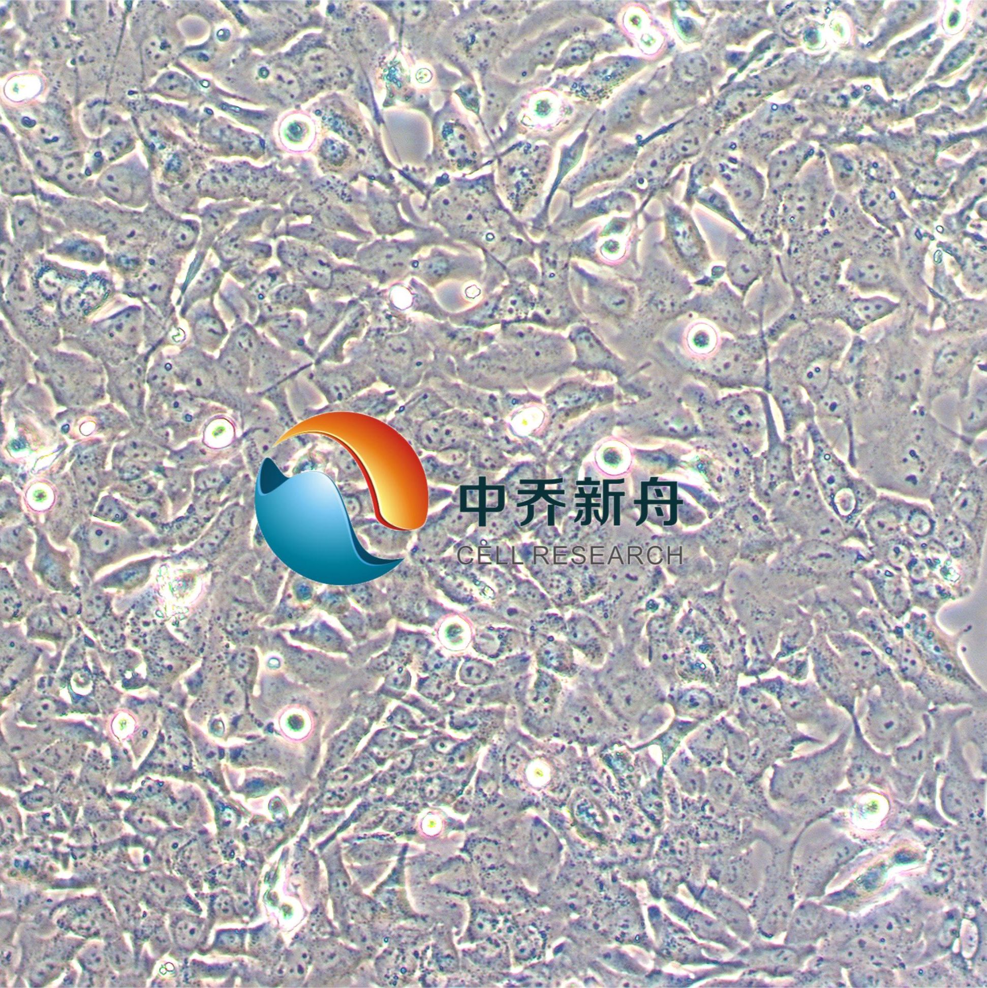 HCC38人乳腺导管癌细胞