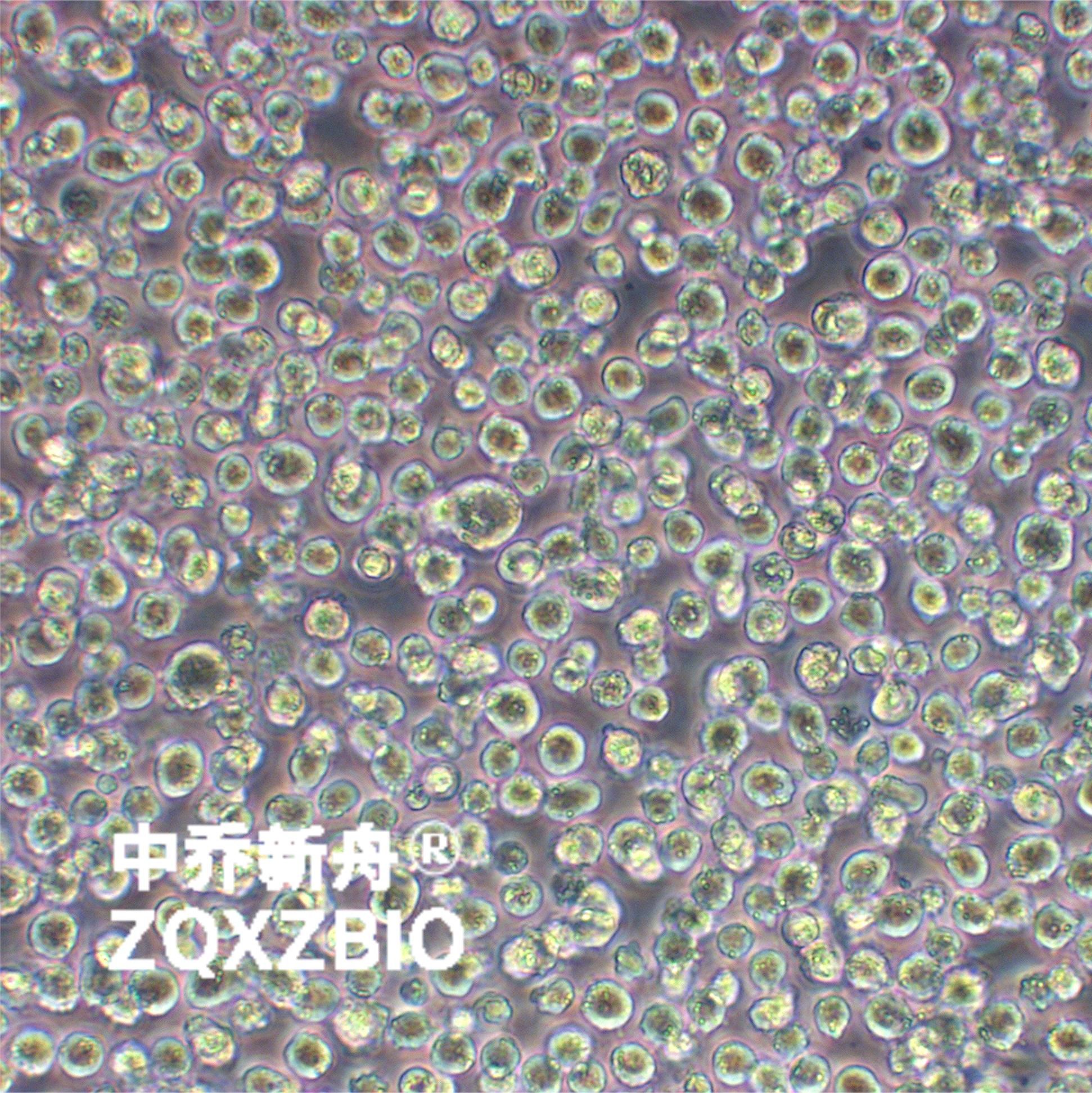 DB人弥漫性大细胞淋巴瘤细胞